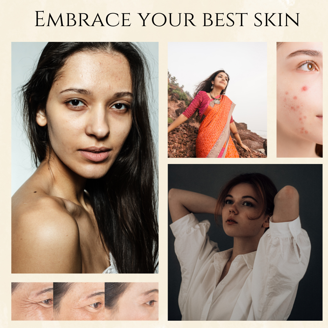 Indian women and their Skin Concerns?